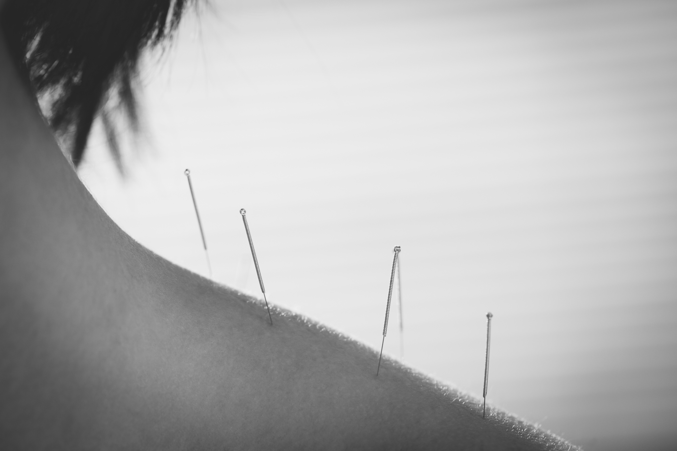 Acupuncture Integral Health & Wellness